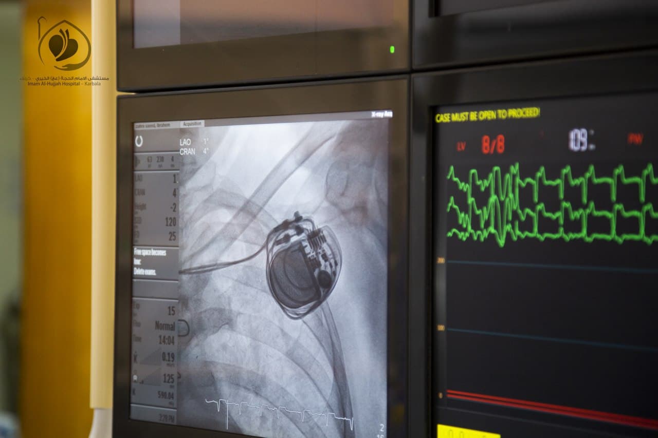 Our Surgical Team Successfully Implants a Permanent Pacemaker for a ...