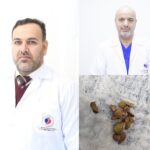في ظل تعقيدات بنيوية وصحية حرجة: عملية نادرة لاستخراج حصاة كلوية لطفلة بوزن 12 كغم