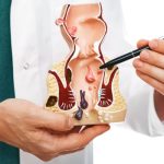 Complex Anal Fistula: The Hidden Battle Beneath the Skin<br><br>