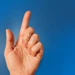 “إصبع الزناد” (Trigger Finger) المرض الصغير ذو التأثير الكبير على حياتك اليومية