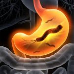 جرثومة المعدة (Helicobacter pylori): خطر يهدد صحة الجهاز الهضمي