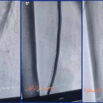 قسطرة علاجية دقيقة تنقذ قدم ثمانيني من البتر في مستشفى الإمام الحجة (عج) الخيري
