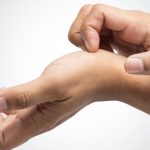 الحكة (Pruritus): دليل صحي شامل