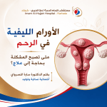 الأورام الليفية في الرحم: متى تصبح المشكلة بحاجة إلى علاج؟